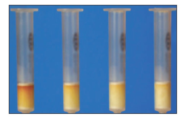 extraction and cleanup of acrylamide in complex matrices using solvent extraction
