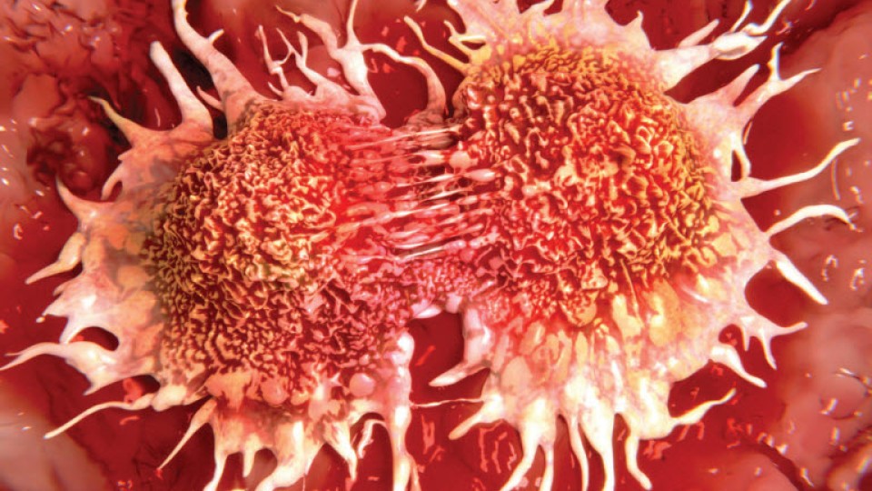 Untargeted Metabolic Profiling of Oral Cancer Cells Using